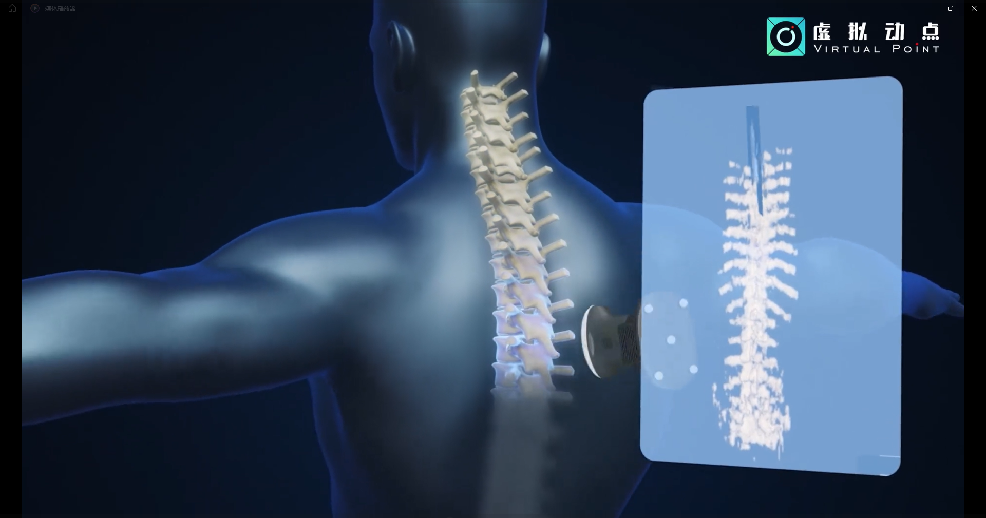 凯发(中国)官网·虚拟动点OptiTrack开创3D超声成像在脊柱诊断中的应用